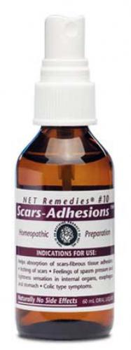 NET-Remedies_10-SCARS-ADHESIONS